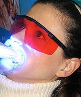 Load image into Gallery viewer, Teeth Whitening Goggles
